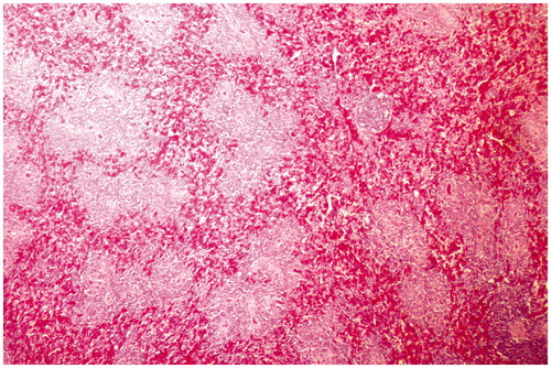 Figure 4. Spleen of broiler chick administered chlorpyrifos (10 mg/kg BW) at day 15 of treatment. Representative photomicrograph shows congestion and degenerative changes. H&E stain. Magnification = 40×.
