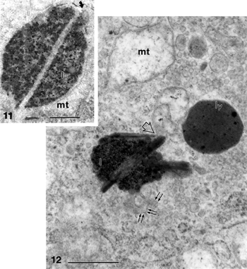 Figures 11 and 12 Needle-like structures in heterogenous lipid deposits (I) (insert). Notice the innumerable adjacent vesicles, altered mitochondrial (mt) fragmented rough ER and polyribosomes. In Figure 12, a network-like array is found at the edge of the main lipidic deposit (pair of small arrows, similar to those found in expelled material in gallstone induction experiments, in Figure 7g of Karkare et al. [Citation[29]]); ly, lysosome; mt, mitochondrion. Scale bars equals to 1 μm.