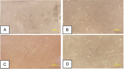 Figure 1 Keloid fibroblast culture. (A) One day after culture procedure. (B) First passage. (C) Second passage. (D) Third passage. Bar: 200 μm.