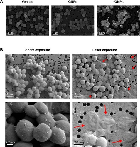 Figure 2 SEM images of MSSA.Notes: (A) Backscattered electron images of MSSA treated with PBG vehicle, nonfunctionalized GNPs, or fGNPs. All images are at 25,000× magnification. Scale bars =1 μm. (B) Secondary electron images showing MSSA treated with fGNPs then sham exposed (left column) or exposed to pulsed laser irradiation at 532 nm (right column). Red arrows indicate damaged bacterial cells. Top two images at 25,000×, bottom left image at 100,000×, bottom right image at 65,000× magnification.Abbreviations: SEM, scanning electron microscopy; MSSA, methicillin-sensitive Staphylococcus aureus; PBG, phosphate buffered saline with bovine serum albumin and glycerol; GNPs, gold nanoparticles; fGNPs, functionalized gold nanoparticles.