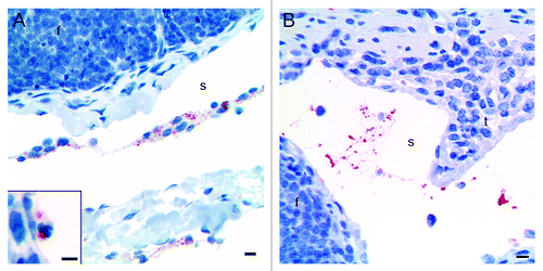 Figure 3. Immunohistochemical labeling with the PrP-antibody BAR224 showed that the inoculated rPrP was present both in cells (A) and cell-free (B) in the submucosal lymphatics. (A) The rPrP was mainly in mononuclear cells (07/F103 30 min BAR224) but also in a few polymorphonuclear cells (A, inset. 09/F607 30 min BAR224). (B) The rPrP was present in cell-free material in submucosal lymphatics (07/F289 30 min BAR224). Scale bars, 10 µm.