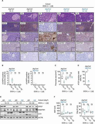 Figure 3. Induction of Atg7-shRNA mice induces apoptosis of the exocrine pancreas. (A) Representative images of pancreatic tissue stained as indicated. Arrows on HE-stained sections indicate dying acinar cells. Scale bars: 20 µm. Inserts are higher magnifications of the boxed area. (B) Quantification of cleaved CASP3 (cCASP3) expression in exocrine and endocrine pancreatic tissue. Statistics: Welch’s t-test (n from left to right: 5, 9, 3, 4, 4, 3 (exocrine) and 5, 9, 3, 5, 4, 3 (endocrine)). (C) Size quantification of pancreata from the indicated cohorts. Statistics: Welch’s t-test (n from left to right: 5, 6, 3, 4, 4, 3). (D) Quantification of ATG7-expressing cells in endocrine (islet) pancreatic tissue. Statistics: Welch’s t-test (n from left to right: 4, 4). (E) Western blots as indicated to validate target knockdown and its effect on SQSTM1 protein expression and LC3 levels. (F) Blood serum AMY and PNLIP activity levels of the indicated cohorts. Statistics: Welch’s t-test (n from left to right: 5, 8, 3, 4, 4, 4 (AMY) and 5, 6, 3, 5, 4, 4 (PNLIP)). *P < 0.05, **P < 0.01, ns: not significant.