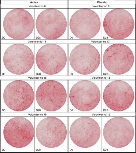 Figure 6 Pictures showing the skin condition of four volunteers before and after 2% RGC serum (active) or placebo treatment during 28 days (Siagraphs).