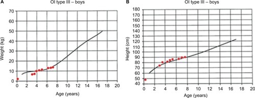 Figure 2 Anthropometric evolution of a patient with OI type III: (A) weight vs. age and (B) height vs. age. Growth charts were developed by Frank Rauch for patients with OI type III.