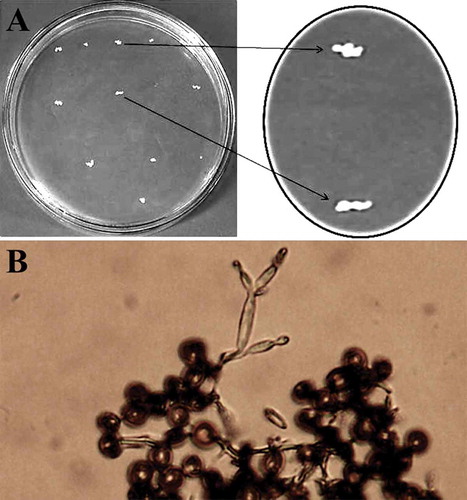 Fig. 2 (a) Colonies of Ustilago cynodontis grown on PDA medium for 6 days at 28°C. Note the irregular edge (slender form); (b) germinated teliospores of U. cynodontis produced basidia with ovoid to long ellipsoidal basidiospores, as seen under a light microscope (40 X)