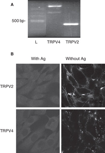 Figure 6. Expression of TRPV channels by MG-63 cells. (A) Total RNA was isolated from MG-63 and used for synthesis of complementary DNA. Amplifications by PCR were performed with specific primers for human TRPV2 or TRPV4. Representative data are shown from RNA isolations of at least three independent cultures with amplified DNA of 686 and 866 bp for TRPV4 (corresponding to variants 2 and 3, and to variants 1, 4 and 5, respectively) and of 432 bp for TRPV2. L: ladder of 100 bp. (B) Localization of TRPV2 and TRPV4 proteins were performed by confocal microscopy with specific antibodies, and revealed by secondary fluorescence antibodies. To ascertain specific fluorescence, primary antibodies have been incubated with related antigens (Ag). Representative data are shown from at least three independent cultures.