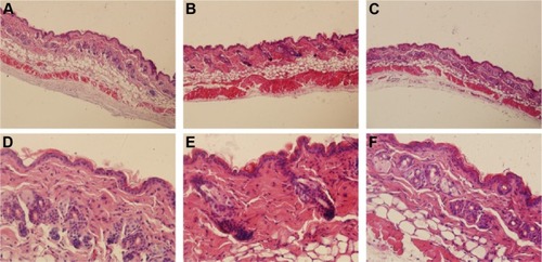 Figure 13 Ordinary optic microscopic pictures of skins.Notes: Microphotographs (100×) of vertical section of skin: (A) untreated skin; (B) skin treated with ethosomal cataplasm; (C) skin treated with conventional cataplasm. Microphotographs (400×) of skin: (D) untreated skin; (E) skin treated with ethosomal cataplasm; (F) skin treated with conventional cataplasm.