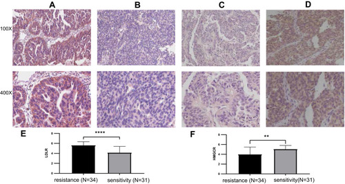 Figure 5 Immunohistochemical analysis of LDLR and HMGCR expression in platinum-resistant (N=34) and platinum-sensitive (N=31) ovarian cancer tissues (magnification 100X or 400X). LDLR expressed at higher levels in platinum-resistant ovarian cancer tissues (A) than that in platinum-sensitive ovarian cancer tissues (B). HMGCR expression was lower in platinum-resistant ovarian cancer tissues (C) than that in platinum-sensitive ovarian cancer tissues (D). Statistical analysis was performed on the staining scores of LDLR and HMGCR in the tumor tissue sections of platinum-resistant and platinum-sensitive patients using t-test. Staining score for LDLR was higher in the tumors from platinum-resistant patients (E). And that of HMGCR was lower in tumors of platinum-resistant patients (F). **p = 0.0012, ****P < 0.0001.