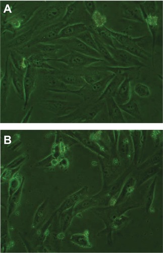 Figure 5 Phase contrast microscopy photographs of MC3T3-E1 cells cultured with (A) nanofluorapatite (n-FA)/polyamide 12 (PA12) composite with 40 wt% n-FA and (B) PA12 at 3 days.