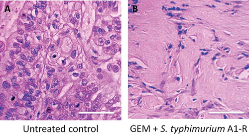 Figure 3. Tumor histology. (a). Untreated control. (b). Tumor treated with GEM+ S. typhimurium A1-R). Scale bars: 100 μm.