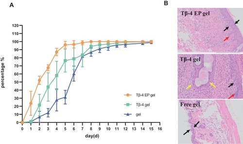 Figure 5 Kunming mice administrated with different gel for 15 days have different degrees of wound healing (A) and the photomicrographs of the healed skin structure of using different preparations (B). In Figure 5B, the black arow indicated the degree of skin thickening, the red arow indicated new capillaries and the yellow arrow showed embolization and localized parakeratosis.Abbreviation: Tβ-4 EP gel, Tβ-4 ethosomal gel.