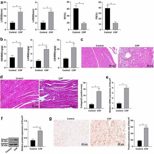 Figure 1. Smurf1 is highly expressed in CHF rats. A: Cardiac function indexes after modeling were detected by echocardiography; B: The ratios of heart weight/body weight, left ventricle weight/body weight, and lung weight/body weight were measured; C: Histopathological changes of the myocardium observed by HE staining; D: Masson staining observed the degree of myocardial tissue fibrosis; E: Expression of Smurf1 in myocardial tissue detected by qRT-PCR; F: Smurf1 protein level in myocardial tissue detected by WB; G: Expression of Smurf1 in the myocardium was detected by immunohistochemical staining; N = 10; Values in the figure were measurement data, which were displayed as mean ± standard deviation. Unpaired t test was used for comparisons. * P < 0.05.