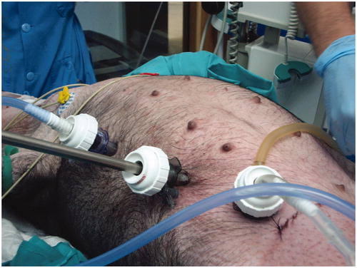 Figure 1. Cytorreductive surgery in a pig model.
