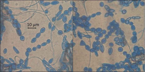 Fig. 2 (Colour online) Representative meiospore of M. roreri strains isolated from six regions of Ecuador.