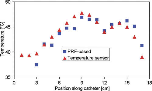 Figure 3. Comparison of the temperatures obtained using the PRFS technique with the temperatures measured by a sensor along the catheter tract in a patient with soft tissue sarcoma of the calf.