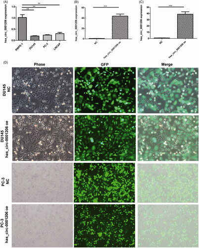 Figure 6. The expression of hsa_circ_0001206 in PCa cell lines and construction of hsa_circ_0001206-overexpressing cells. (A) Expression of hsa_circ_0001206 in RWPE-1, PC-3, DU145, and LNCaP cells (n = 3 repeats for each cell line). (B) The expression of hsa_circ_0001206 in hsa_circ_0001206-overexpressing DU145 cells and negative control DU145 cells detected by qRT-PCR. (C) The expression of hsa_circ_0001206 in hsa_circ_0001206-overexpressing PC-3 cells and negative control PC-3 cells detected by qRT-PCR. (D) Phase contrast and fluorescent images of hsa_circ_0001206-overexpressing cells (DU145 and PC-3) and negative control cells (DU145 and PC-3) at the fifth passage.