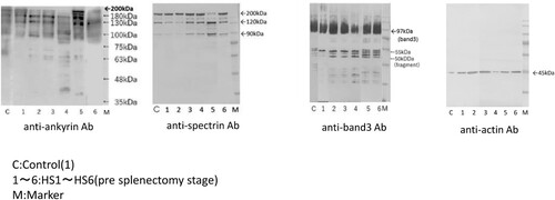 Figure 3. Western blotting (anti-spectrin Ab, anti-spectrin Ab, anti-band 3 Ab, anti-actin Ab).