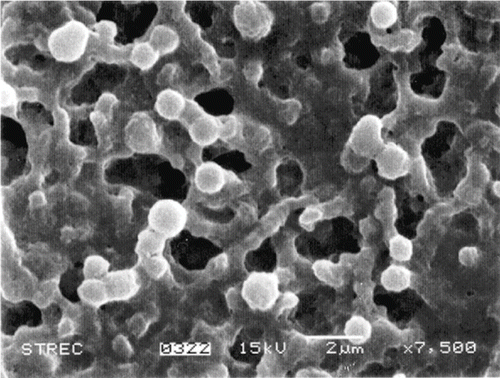 Figure 5 Scanning Electron Micrograph at 7500 times enlargement of 0.1–3 μm MP3 from mung bean protein concentrate.