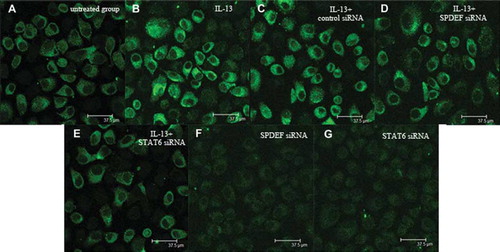 Figure 8. Intracellular MUC5AC protein production in 16HBE cells. The cells were transfected with SPDEF siRNA or STAT6 siRNA and treated with IL-13 for 24 h in 16HBE cells. The cellular protein was detected by immunofluorescence and observed by confocal laser scanning microscopy (CLSM) (800 × magnification). The cellular MUC5AC protein in each group was detected using MUC5AC antibody (45M1) and fluorescein isothiocyanate (green) goat anti-mouse IgG, as described in Materials and Methods.