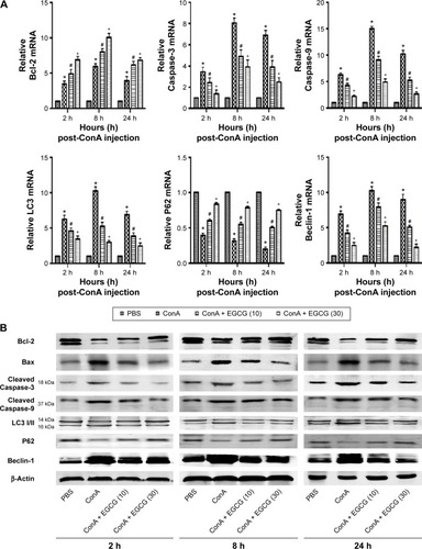 Figure 5 Effects of EGCG on apoptosis and autophagy in mice with ConA-induced acute hepatitis.