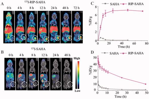 Figure 4. MicroSPECT/CT images of 125I-RIP-SAHA (A) and 125I-SAHA (200 µCi) (B) in 4T1 tumor-bearing BALB/c mice after intravenous injection over time. (C) Tumor uptake of 125I-SAHA and 125I-RIP-SAHA at different times quantified by microSPECT/CT images. (D) Pharmacokinetics of 125I-SAHA and 125I-RIP-SAHA (20 µCi) in health mice following intravenous injection (n = 3).