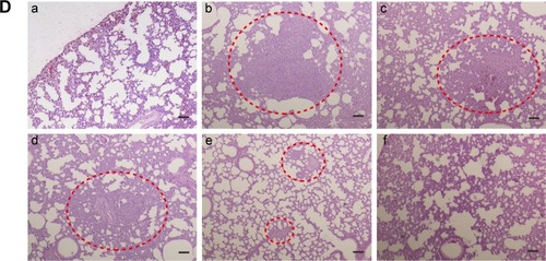 Figure 5 In vivo antitumor effect on 4T1 tumor-bearing Balb/c mice.Notes: (A) Tumor volume of mice treated with different formulations (n=3). ***P<0.001 represents M-PLL/siRNASur group and M-PLL/siRNASur+NIR group versus the saline group, respectively; *P<0.05 represents M-PLL/siRNASur+NIR group versus the M-PLL/siRNASur group. (B) Body weight variation of mice in the duration of treatments. (C) Typical lung tissue photographs of 4T1 tumor-bearing mice treated with saline (a), M-PLL/siRNAN.C. (b), M-PLL/siRNAN.C.+NIR (c), M-PLL/siRNASur (d) or M-PLL/siRNASur+NIR (e), respectively. Red arrows indicate the white nodules on the surfaces of lung lobes. (D) Representative H&E-stained lung section of 4T1 tumor-bearing mice treated with salin (b), M-PLL/siRNAN.C. (c), M-PLL/siRNAN.C.+NIR (d), M-PLL/siRNASur (e) or M-PLL/siRNASur+NIR (f), respectively. Lung tissue of normal mouse was used as a control (a). Red dotted circles show the tumor metastasis loci in the lungs. Scale bar is 100 μm, magnification ×40.Abbreviations: H&E, hematoxylin and eosin; M-PLL, melanin-poly-L-lysine; siRNAN.C., siRNA of nonsense sequences; NIR, near infrared; PBS, phosphate-buffered solution; siRNA, small interference RNA; siRNASur, survivin-targeted siRNA.