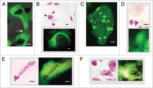 Figure 4 Cells with bell shaped nuclei in post-syncytial stage in human fetal tissues. (A) Syncytial narrowing and fragmentation (arrow), brain, 13 wks. (B) Early stage of amitotic symmetrical stacking bell-to-bell nuclear fission (arrow) in narrowing syncytium (upper) and green Feulgen fluorescence image superimposed on purple stained Feulgen image (lower), brain, 13 wks. (C) Bright green Feulgen fluorescence delineates distribution of cytoplasms attached to bell shaped nuclei in small intestinal villus (11 wks). All cells with “closed” nuclear morphologies observed to date emit relatively little cytoplasmic green Feulgen fluorescence. (D) Feulgen purple stained post-syncytial bell shaped nucleus among closed nuclei (upper) and green Feulgen fluorescence superimposed on purple stained Feulgen image (lower). Note the intense Feulgen fluorescence of the post-syncytial, balloon-like cytoplasm emanating from bell shaped nucleus (human fetal colon, 12 wks). (E) Feulgen purple stained asymmetrical “bell-to-cigar” nuclear fission in post-syncytial single cell with bell shaped nucleus (left) and green Feulgen fluorescence superimposed on purple stained Feulgen image (right), small intestine, 12 wks. (F) Feulgen purple stained asymmetrical ‘bell-to-oval’ nuclear fission in post-syncytial single cell with bell shaped nucleus (left) and green Feulgen fluorescence superimposed on purple stained Feulgen image (right), small intestine, 12 wks. Scale bars, 10 µm except 40 µm in (C).