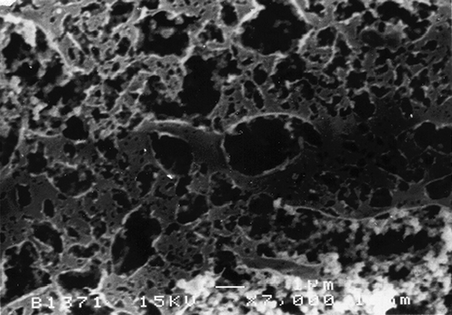 Figure 3 SEM micrograph of Fromase milk coagulum (7000×).