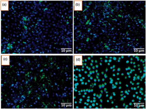 Figure 12. Qualitative assessment of fluorescence intensity associated with MCF-7 cells by the incubation of coumarin-6 loaded CQD-Glu-β-CD nanocarrier for 1 (a), 3 (b), 6 (c), and 12 h using blue filter (excitation wavelength 460–490 nm, emission 470 nm) in inverted fluorescence microscopy.