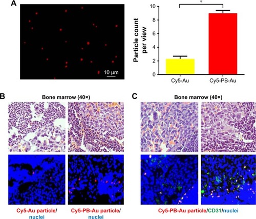 Figure 6 (A) Cy5-PB-Au particle under fluorescence microscopy. (B) Accumulation of a few Cy5-Au particles within tumor in bone marrow and marked accumulation of Cy5-PB-Au particle within tumor in bone marrow (red: Cy5-Au/Cy5-PB-Au particle; blue: nuclei) (*P<0.05). (C) Colocalization of Cy5-PB-Au particle with a vascular endothelial cell marker within tumor in bone marrow (red: Cy5-PB-Au particle; green: CD31; blue: nuclei).