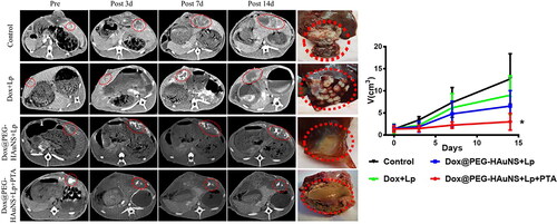 Figure 2. Tumour size changes after treatment. Enhanced computed tomography showed changes in tumour size after treatment of rabbit VX2 liver cancer. Red circles represent tumour lesions in the arterial phase. During the 15-day observation period, intra-hepatic arterial injections of doxorubicin-loaded hollow Au nanospheres coated with PEG combined with photothermal ablation significantly inhibited tumour growth.Note: * indicates P < 0.05.