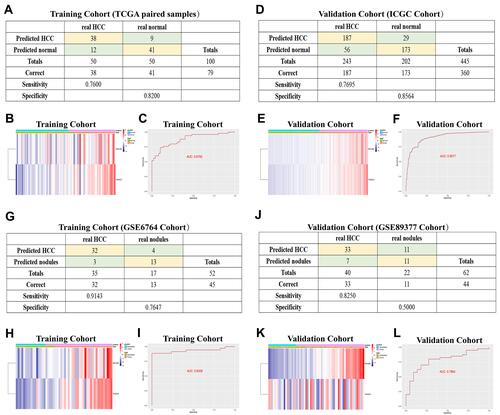 Figure 8 Diagnostic models constructed to distinguish HCC patients from normal individuals (A–F) and HCC from dysplastic nodules (G–L). (A and D) Confusion matrix of binary results indicated that the diagnostic model accurately distinguished HCC patients and normal individuals. (B and E) The expression profiles of MYL6B and THOC2 in HCC patients and the consistency between the predicted disease status and actual disease status (C and F) ROC curves determined the superior predictive performance of the diagnostic model. (G and J) The diagnostic model distinguished HCC and dysplastic nodules with high specificity and sensitivity. (H and K) Expression characteristics of MYL6B and THOC2 in HCC patients, distribution of the predicted disease status and actual disease status. (I and L) ROC curves validated the predictive value of the diagnostic model.