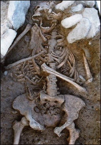 Figure 3. An infant of 38–41 weeks gestation (Skeleton CCLIII) from Mount Gamble, Co. Dublin, lying in cephalic position with the right occiput transverse, in an oblique lie (photograph courtesy of Edmond O’Donovan).