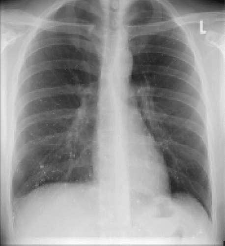 Fig. 1.  Chest x-ray showing radio dense punctate lesions.
