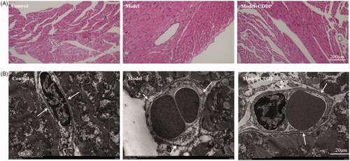 Figure 4. Pre-treatment with CDDP alleviated endothelial injury. (A) ×200 light microscope and (B) transmission electron microscope showed CDDP alleviated the oedema of endothelial cells (white arrow).