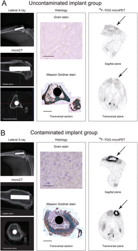 Figure 2. Results of radiology, histology, and microPET 6 weeks after surgery. A. Uncontaminated implant group. The lateral X-ray (upper left panel) shows normal bone morphology. Micro-CT images (the 2 lower left panels) indicate a healthy cortex with bone apposition on the implant surface. Transversal micro-CT corresponds to the transversal histology section (lower image in middle panel; bar represents 4 mm), which indicates bone apposition on the implant and normal bone morphology. Absence of Gram-positive bacteria confirmed the absence of infection (upper image in middle panel; bar represents 20 µm). Reconstructed 18F-FDG microPET planes (right panel) indicate tracer uptake and implant location (arrows). B. Contaminated implant group. Lateral X-ray (upper left panel) indicates cortical thickening and osteolysis. Micro-CT (the 2 lower left panels) supports the findings on X-ray images, with cortical thickening and extensive osteolysis. Transversal micro-CT corresponds to the transversal histology section (lower middle panel; bar represents 4 mm), additionally indicating the presence of an intramedullary abscess. The presence of Gram-positive bacteria confirmed the presence of a bacterial infection (upper middle panel; bar represents 20 µm). Reconstructed 18F-FDG microPET planes (right panel) indicate implant location and increased tracer uptake (arrows).