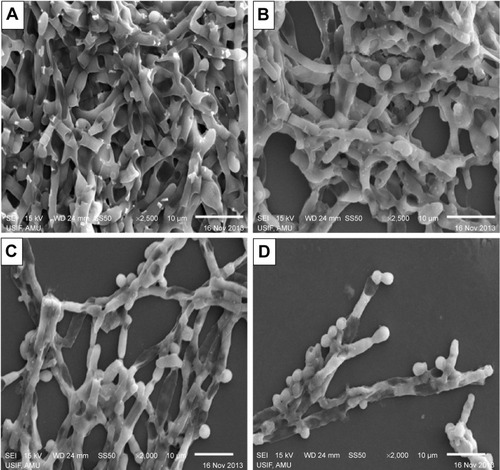 Figure 8 Scanning electron micrographs of inhibition of Candida albicans biofilm mediated by the AmB–PGA formulation.Notes: (A) Untreated control image of biofilm, (B) AmB-L treated biofilm, (C) biofilm treated with AmB-D, and (D) biofilm treated with AmB–PGA.Abbreviations: AmB, amphotericin B; AmB-D, Fungizone®; AmB-L, Ambisome®; PGA, polyglutamic acid.