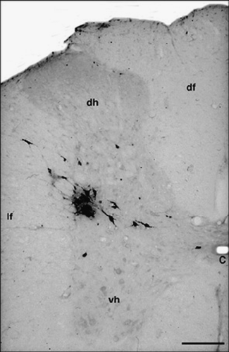Figure 1 T10 spinal cord. Coronal section. Ba-Prv virus-labeled neurons in the IML cell column 3.5 day after inoculation. Abbreviations: C, central canal; df, dorsal funiculus; dh, dorsal horn; lf, lateral funiculus; vh, ventral horn. Scale bar = 200 μm.