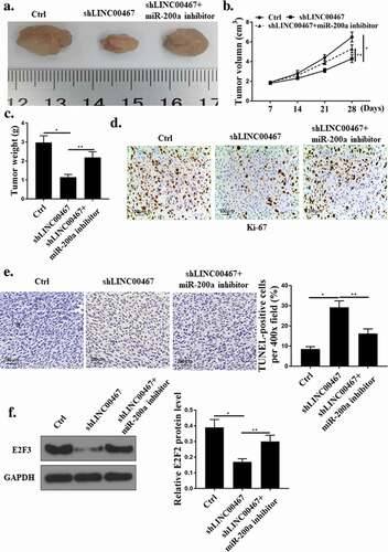 Figure 6. LINC00467-miR-200a axis regulated the growth of glioma cell tumors. (a). Image of tumor tissue. (b). Tumor volume. (c). Tumor weight. (d). Ki67 immunohistochemical staining. (e). TUNEL staining. F. E2 F3 protein expression level. N = 3, * p < 0.01, ** p < 0.05