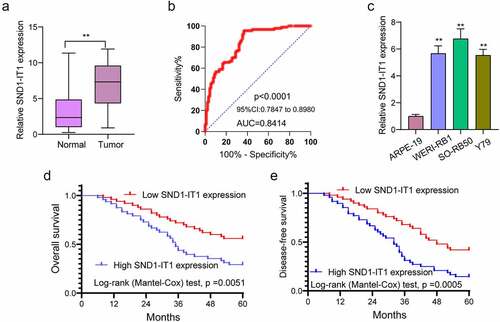 Figure 1. The expression of SND1-IT1 in RB and its clinical significance. (a) SND1-IT1 expression in RB specimens and normal retina tissues was measured using RT-PCR. (b) ROC curves of SND1-IT1 expression for differentiating RB tissues from normal tissue. (c) Relative expression of SND1-IT1 in WERI-RB1, SO-RB50, Y79 and ARPE-19 cells. (d,e) Overall survival rate and disease-free survival rate were calculated using the Kaplan-Meier analysis. **p < 0.01, *p < 0.05