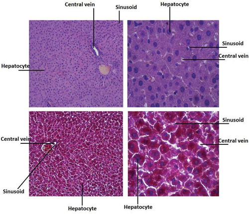 Figure 5. Microscopy of liver samples in diabetic rats receiving gavage of walnut oil with high dose of β-sitosterol; (a) H&E (20 µm); (b) H&E (100 µm); (c) trichrome (20 µm); (d) trichrome (100 µm).
