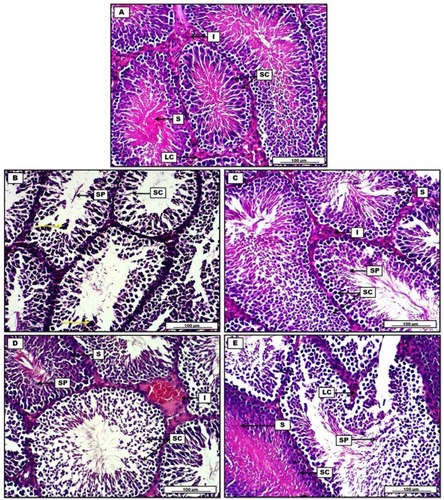 Figure 9 Photomicrograph of testis from groups; (A) control group shows normal morphogenic arrangement of spermatic cells (SC) and seminiferous tubules (S) which enclose a dense pinkish appearance of spermatozoa tails. Leydig cells (LC) with prominent acidophilic cytoplasm in the interstitial connective tissue (I). (B) Doxorubicin group demonstrates germinal aplasia with degeneration in spermatogenic cells (SC), sloughing of germ cells evident by dead sperm cells fragments (SP), presence of hyperchromatic apoptotic debris (yellow arrows). (C) Doxorubicin, quercetin and sitagliptin group display significant morphogenic improvements in the spermatogenic cells (SC), spermatic repopulation and regeneration (SP) can be seen within seminiferous tubules (S), interstitial tissue (I) show distinctive distribution. (D) Doxorubicin and sitagliptin group show regeneration of germinal epithelium (SP) of some seminiferous tubules (S), other spermatogenic cells show degenerative changes, evident by cellular debris (SC). Blood vessels congestion in the interstitium (I). (E) Doxorubicin and quercetin group show regeneration of germinative spermatogenic cells (SC) within the seminiferous tubules (S), presence of cellular debris in the lumen (SP). H&E. Scale bars: 100 µm.