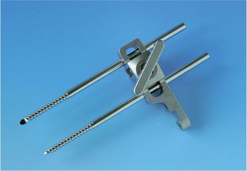 Figure 2. Double-screw MIRA system.