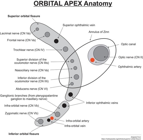 Figure 1 Diagram representing the anatomy of the orbital apex.Notes: Adapted from Hacking C. Orbital apex (diagram). © 2017 Craig Hacking; CC-BY-SA-NC. Radiopedia.org. Available from: https://radiopaedia.org/cases/orbital-apex-diagram-1?lang=us. Accessed 28 November 2019.Citation31