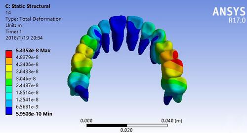 Figure 6 Cloud diagram of traction on the lip side.