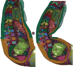 Figure 2. Example of simulation: Hardy et al. (Citation2001) mid-abdomen bar impact at 6 m/s scaled to the subject GI4. Another example is provided in Appendix A-3 (see online supplement).