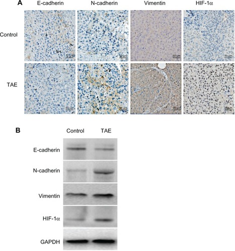 Figure 7 The effect of TAE on the changes of EMT in vivo.