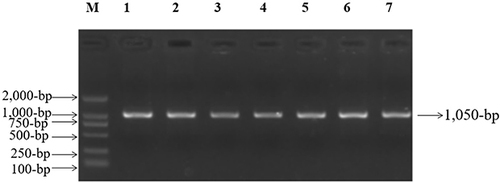 Figure 2 PCR amplification of mt-tRNAGlu gene in subjects with NSHL, arrow indicated the PCR product, which was 1050-bp.