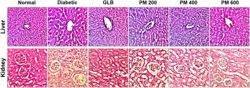 Figure 3. Histopathological changes in the liver and kidney of alloxan-induced diabetic rats following treatment with glibenclamide (GLB) and polyherbal mixture (PM) at 200, 400 and 600 mg/kg for 6 weeks (magnification: x400).