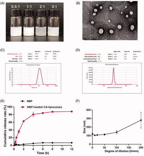Figure 1. Characterizations of NBP-loaded CA-liposomes. (A) Representative photos of NBP-loaded CA-liposomes prepared at PC-98T/CA ratios = 0.5:1, 1:1, 2:1 and 3:1, respectively. (B) Representative TEM image, (C) Particle size distribution and (D) Zeta potential of the optimized NBP-loaded CA-liposomes prepared at the PC-98T/CA ratio of 3:1. (E) In vitro NBP release profiles from free NBP solution and NBP-loaded CA-liposomes. (F) Size changes of NBP-loaded CA-liposomes that were diluted 10 times to 200 times with de-ionized water. Data are mean ± SD (n = 3).